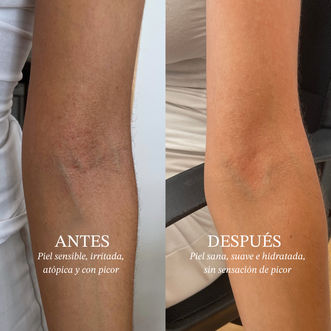 Gel de cuerpo suavizante